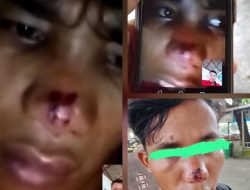 Diduga Telah Terjadi Tindak Pidana Pengeroyokan Dan Penculikan Atas Anak Yatim Piatu Muhammad Ramadoni Rambe